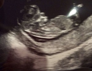 my grandchild afloat in her mother's womb